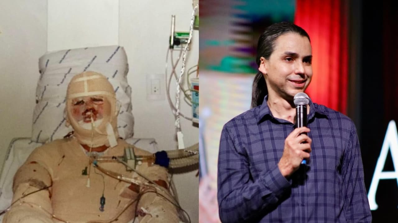 Pastor sobrevive a grave acidente e testemunha: “Estou vivo para a glória de Deus” 1 Pastor sobrevive a grave acidente e testemunha: “Estou vivo para a glória de Deus”