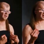 A Inspiração de Kenzie: Vivendo Com Propósito Apesar da Síndrome Rara