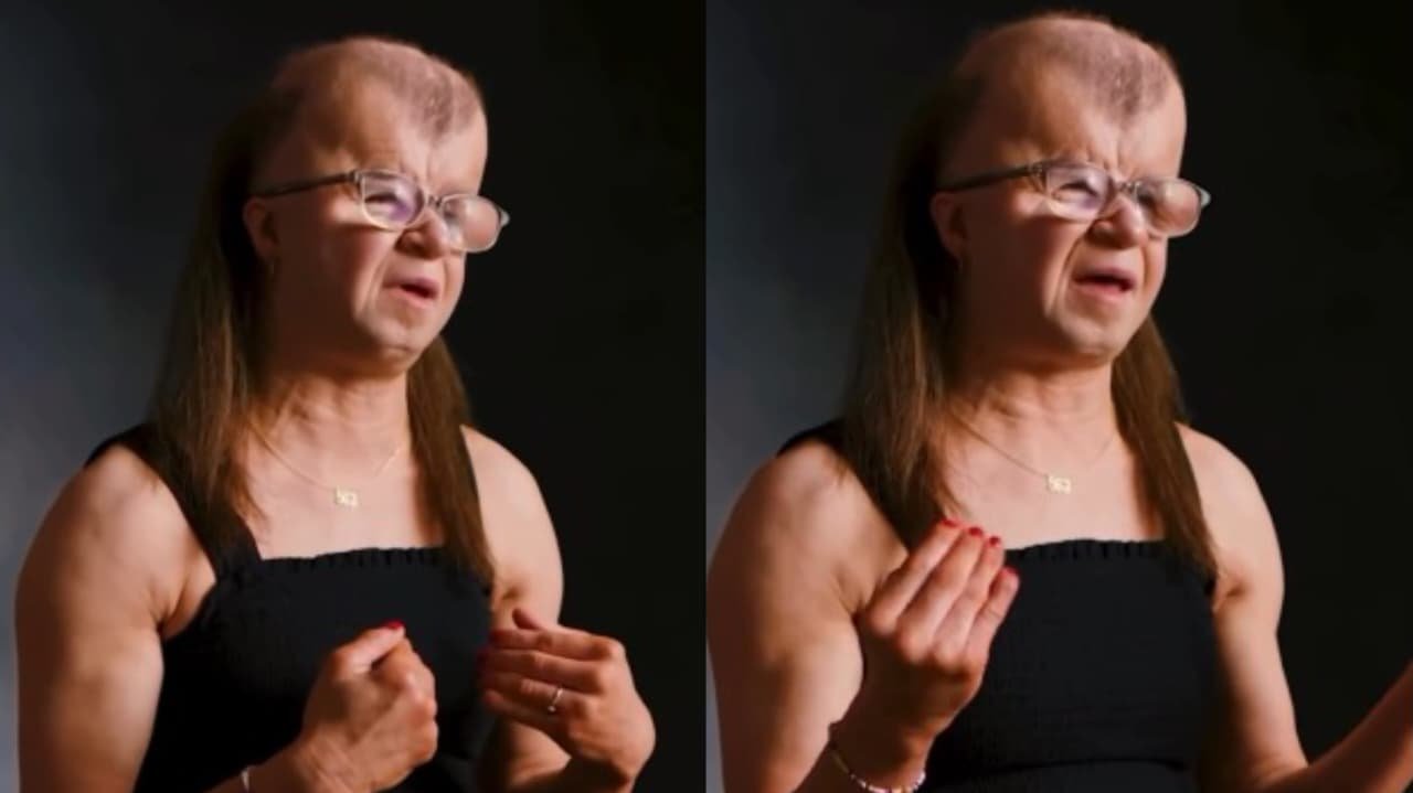 Mulher com síndrome